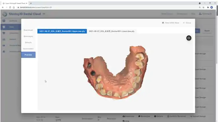 scanner-intraoral-preview-3d